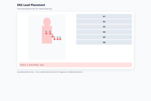 EKG Lead Placement – WordPress plugin